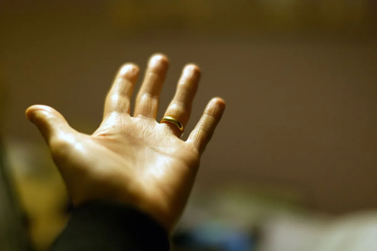 An open hand resting palm up with a wedding ring on the finger